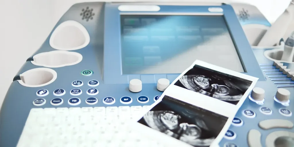 Ultrasound Machine
